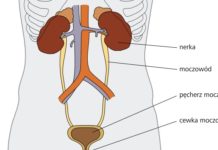 dieta na układ moczowy