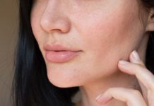 Jak walczyć z niedoskonałościami skóry twarzy