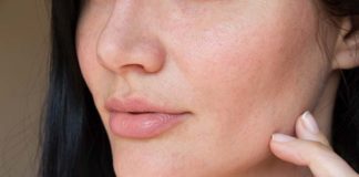 Jak walczyć z niedoskonałościami skóry twarzy